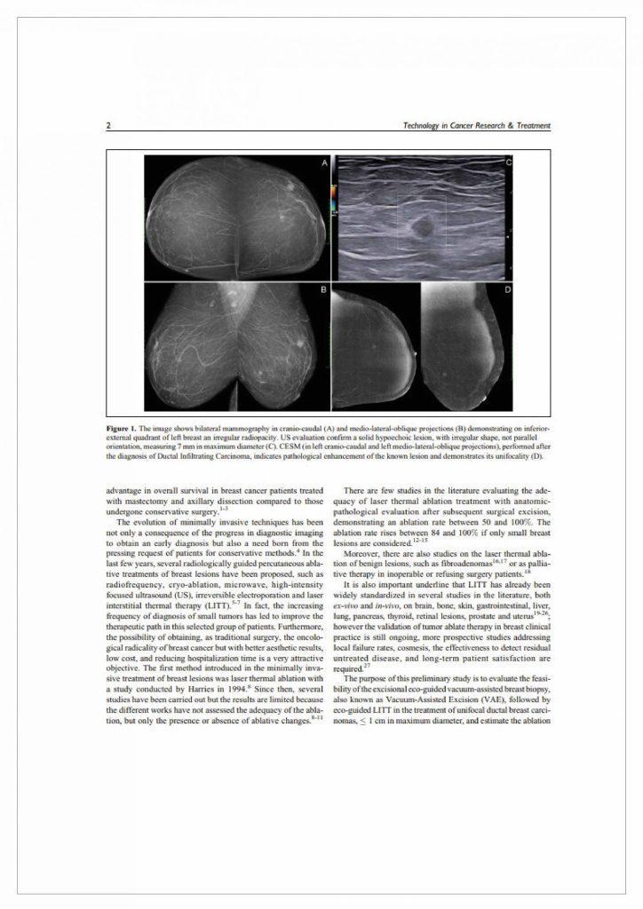 biopsja fuzyjna a aspiracyjna analiza porownawcza 02 02 scaled 724x1024 - Biopsja aspiracyjna i ablacja laserowa w przypadku zmian piersi - analiza porównawcza