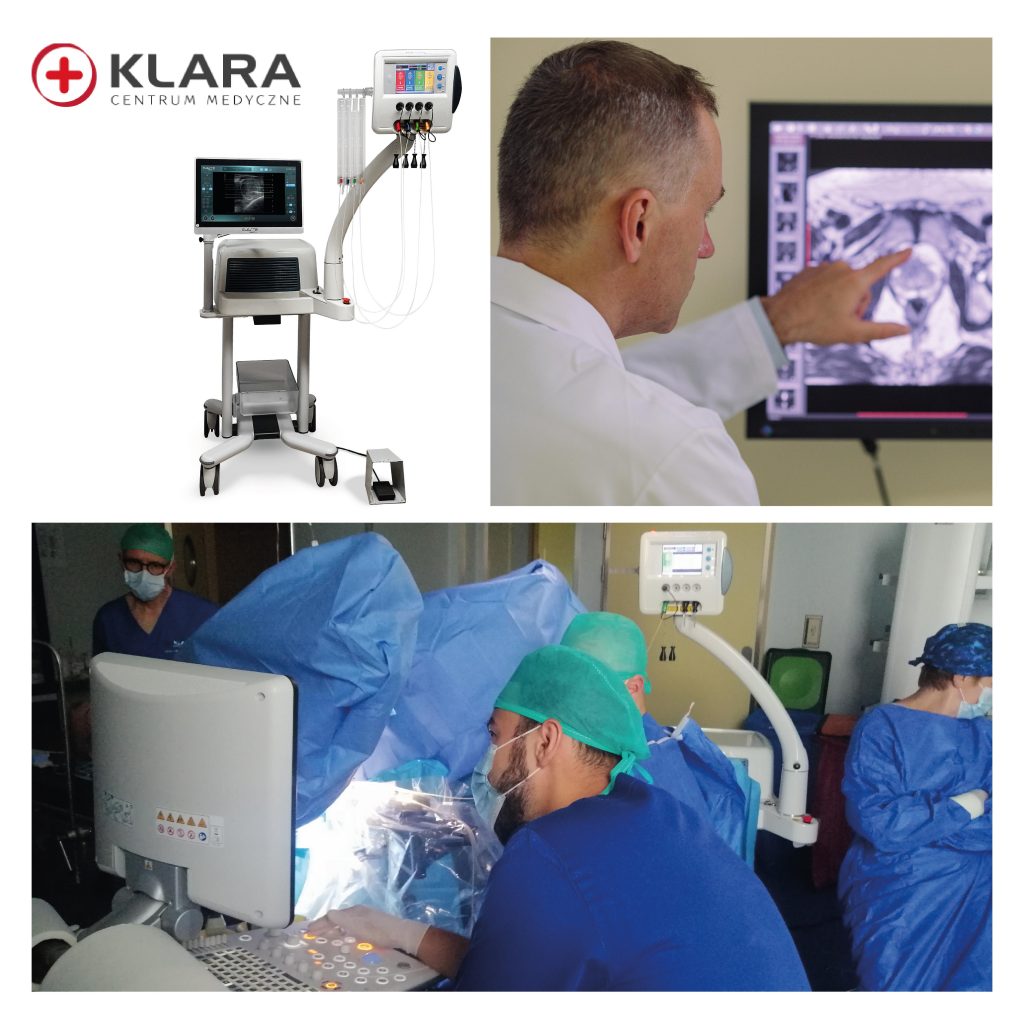 szkolenie cm klara 03 1 1024x1024 - Echolaser w leczeniu BPH - szkolenie w CM Klara